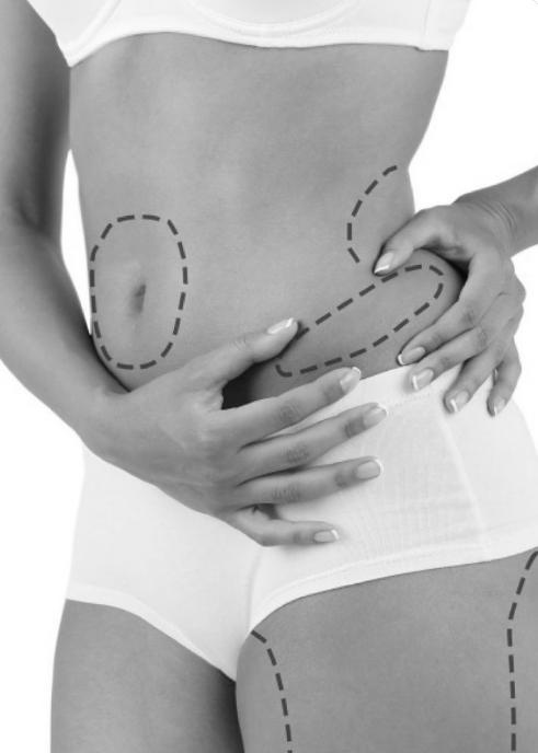 Liposucción en la República Dominicana para contorno corporal avanzado