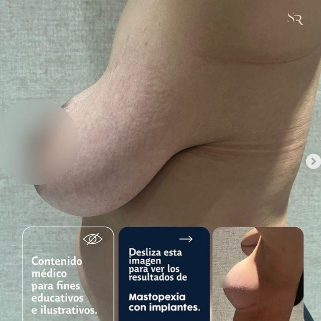 Dr. Samuel Martinez Recio resultado de paciente 3