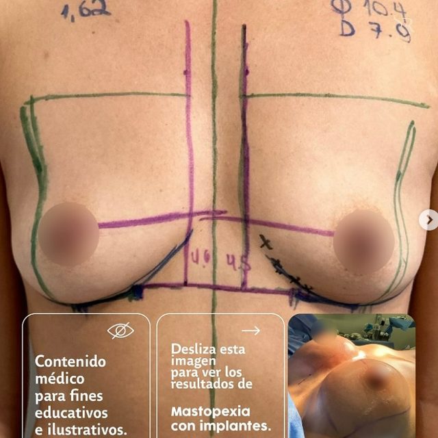 Dr. Samuel Martinez Recio resultado de paciente 4