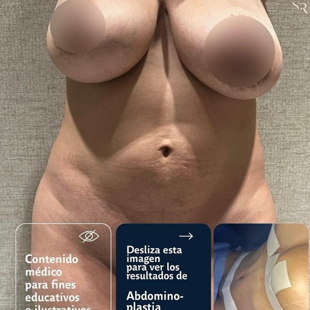 Dr. Samuel Martinez Recio resultado de paciente 5